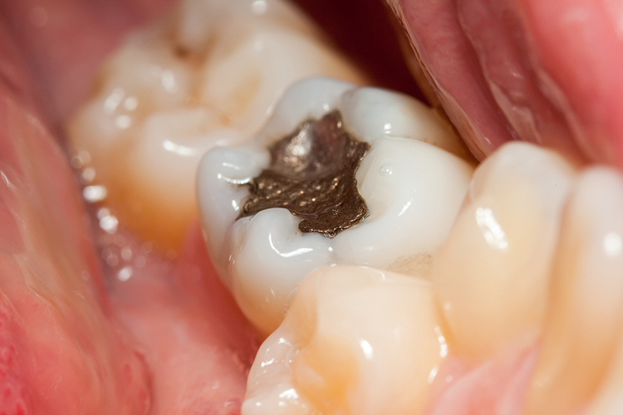 Cavity Image